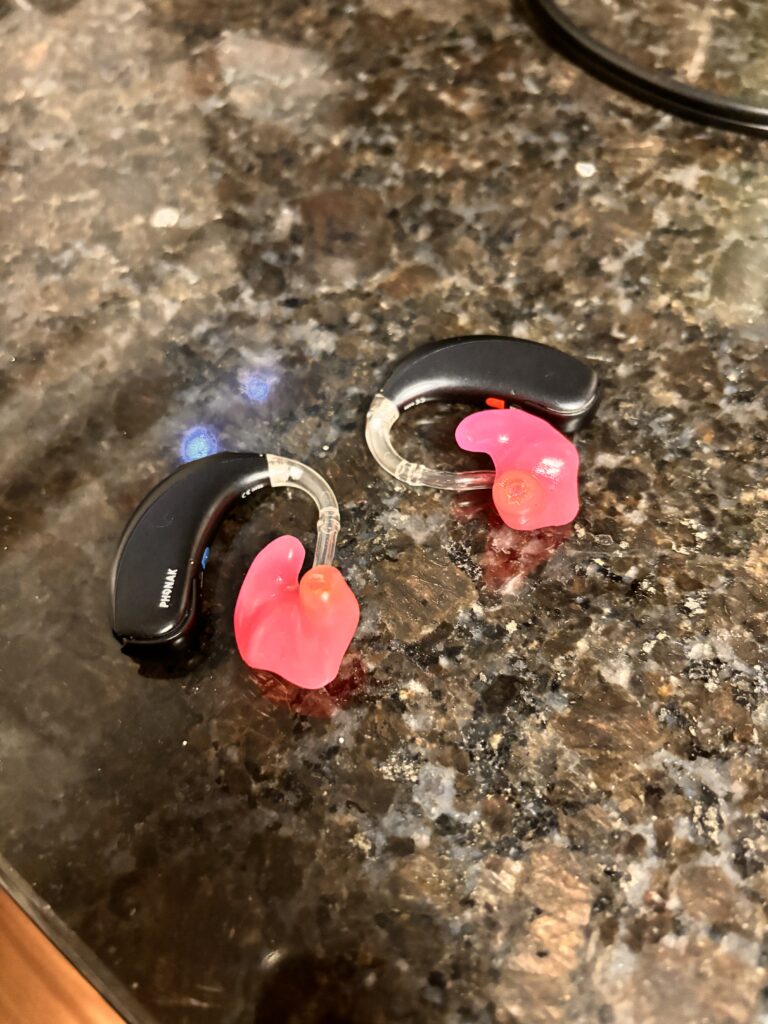 A close-up of Rikki's black and pink hearing aids